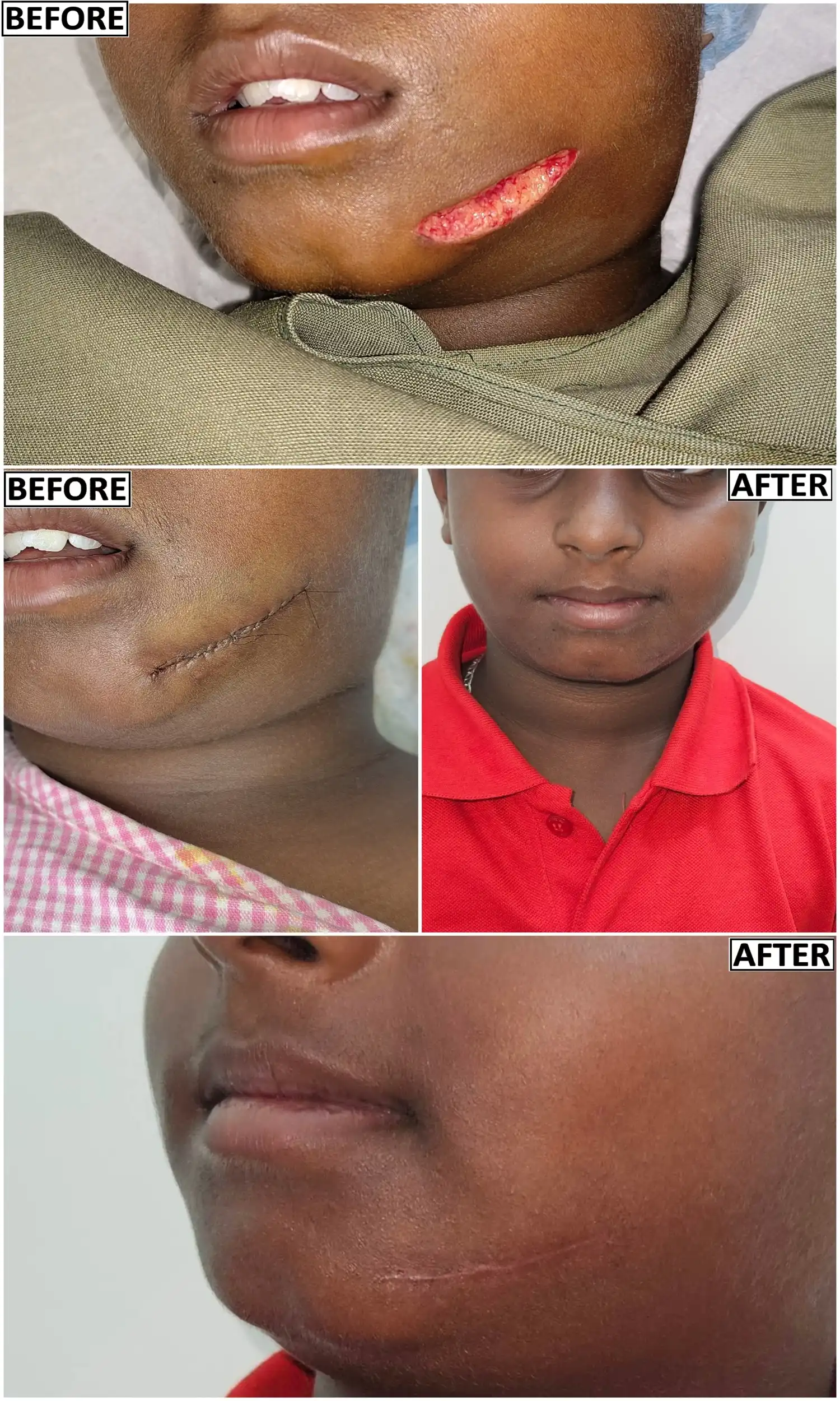 Before and after of cut injury to face