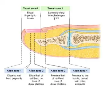 Before and after Allen classification by Dr. Amrika Seshadri