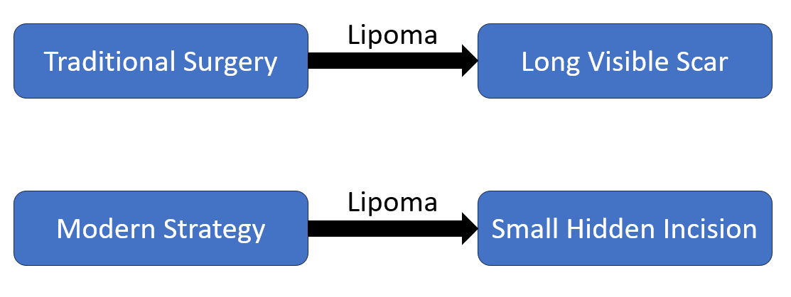 Lipoma