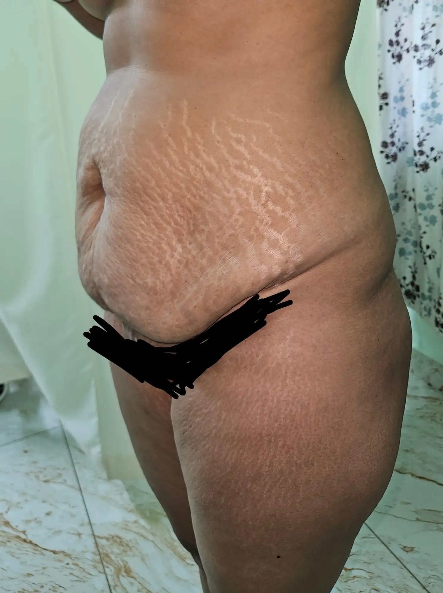 midsection-sculpting
