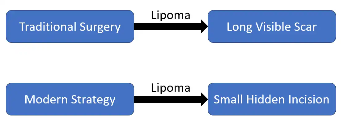 cosmetic lipoma removal