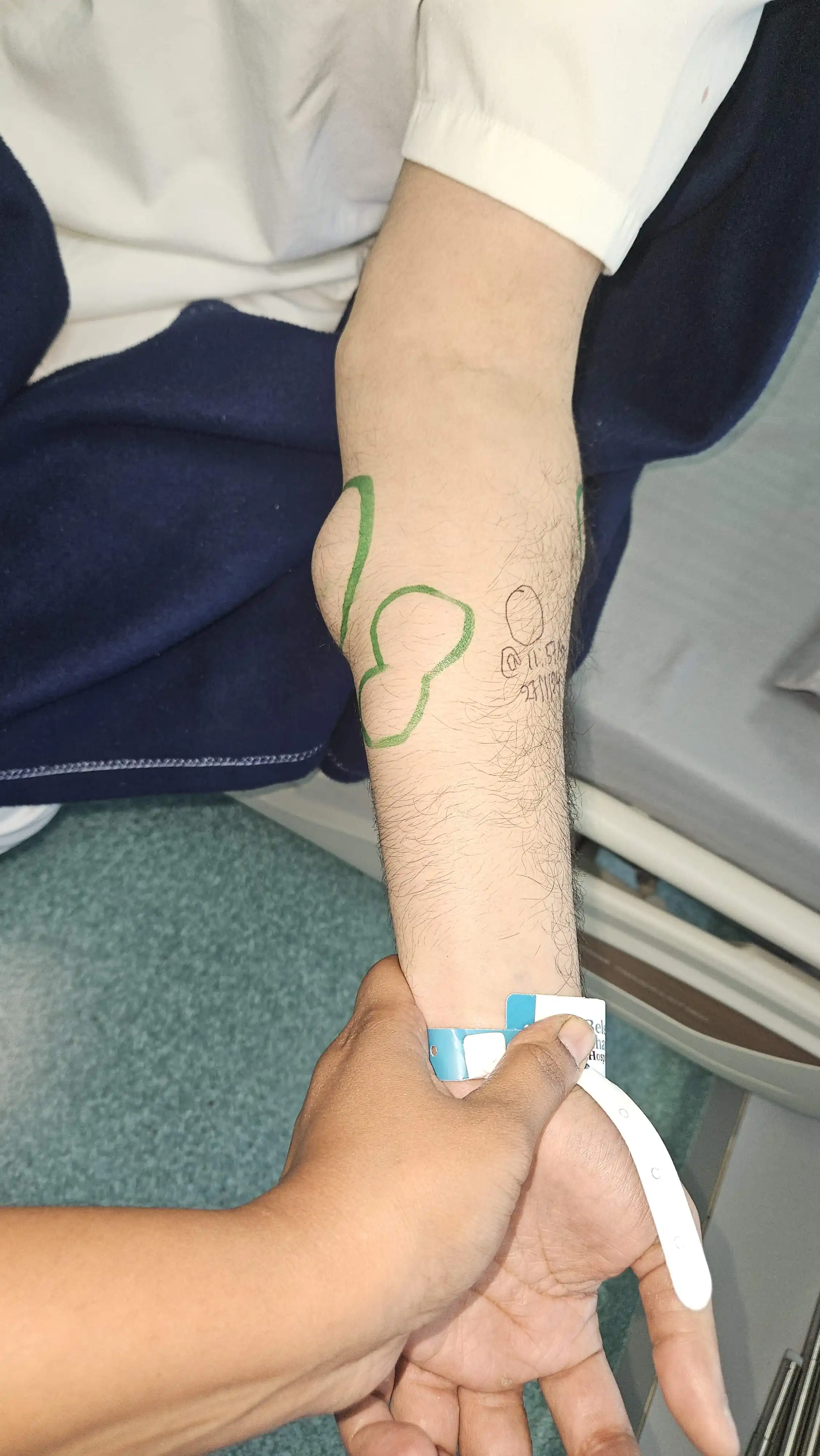 pre operative mapping